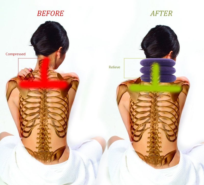 RUNZI Cervical Neck Traction Device Inflatable Neck Stretcher, Easy to Use for Chronic Neck and Shoulder Pain Relief Traction Spine Alignment, Neck Cervical Braceï¼ŒPurple - Image 3